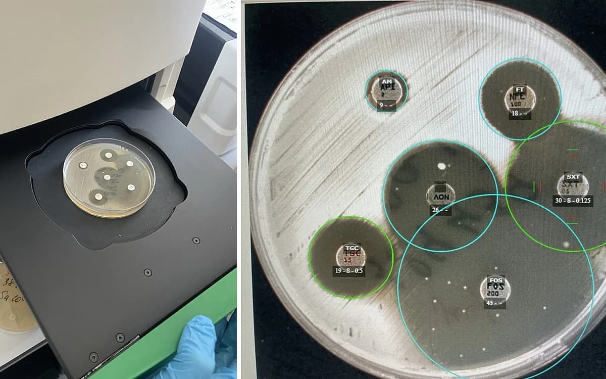 Microbiology laboratory plate reader inspecting antibacterial inhibition zones on agar